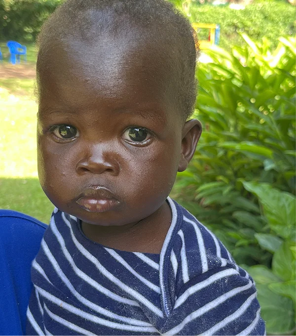 A young child with dark skin and big eyes, wearing a striped shirt, stands in a lush green outdoor setting.